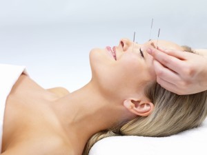Read more about the article What You Need to Do About Acupuncture