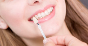 Read more about the article Dental crowns for making your teeth in the original shape