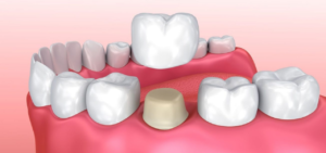 Read more about the article Why Do Children Need Oral Healthcare at Different Ages and Stages?