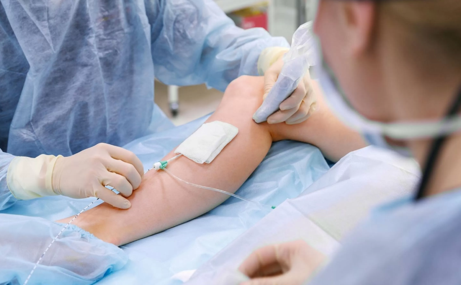 You are currently viewing A Comprehensive Guide to Endovenous Vein Treatment