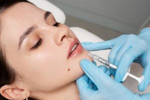 Lip Fillers